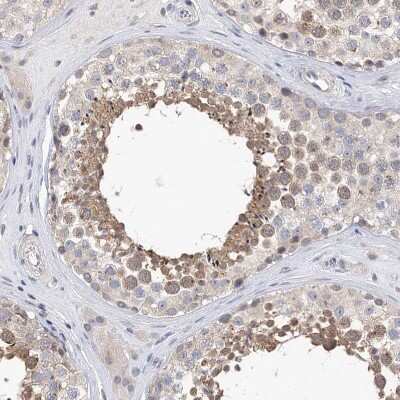 Immunohistochemistry-Paraffin: KIAA1109/FSA Antibody [NBP1-82145]
