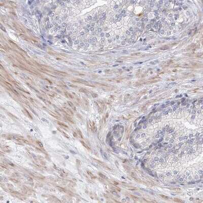 Immunohistochemistry-Paraffin: KIAA1109/FSA Antibody [NBP1-82145]