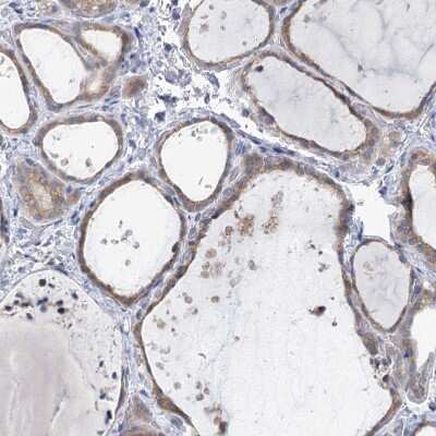 Immunohistochemistry-Paraffin: KIAA1109/FSA Antibody [NBP1-82145]