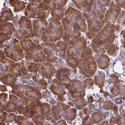 Immunohistochemistry-Paraffin: KIAA1143 Antibody [NBP1-92051]