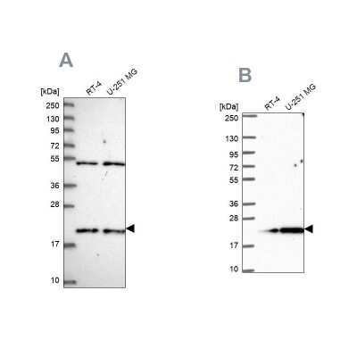 Western Blot: KIAA1143 Antibody [NBP1-92051]