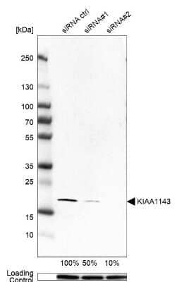 Western Blot: KIAA1143 Antibody [NBP2-57324]