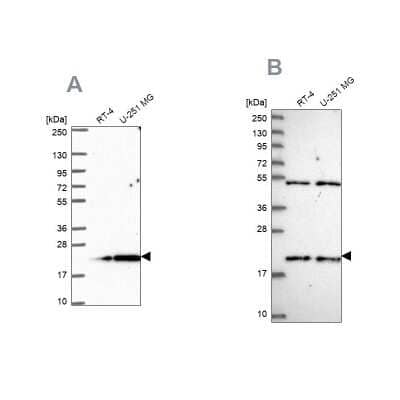 Western Blot: KIAA1143 Antibody [NBP2-57324]