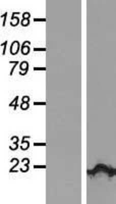 Western Blot: KIAA1143 Overexpression Lysate [NBL1-12258]