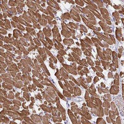 Immunohistochemistry-Paraffin: Myogenesis-Regulating Glycosidase Antibody [NBP2-31830]