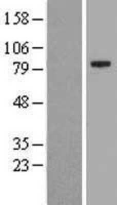 Western Blot: Myogenesis-Regulating Glycosidase Overexpression Lysate [NBL1-12259]