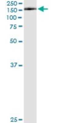 Immunoprecipitation: CEMIP/KIAA1199 Antibody (3C12) [H00057214-M01]