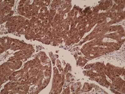 Immunohistochemistry: CEMIP/KIAA1199 Antibody (V98P4E1*B7) - BSA Free [NBP2-50336]