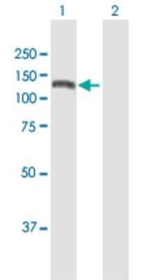 Western Blot: CEMIP/KIAA1199 Antibody [H00057214-B01P]