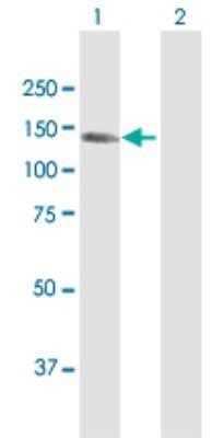 Western Blot: CEMIP/KIAA1199 Antibody [H00057214-D01P]