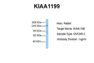 Western Blot: CEMIP/KIAA1199 Antibody [NBP1-58029]