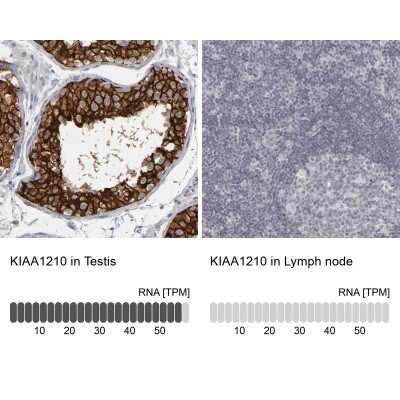 Immunohistochemistry-Paraffin: KIAA1210 Antibody [NBP1-90958]