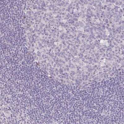 Immunohistochemistry-Paraffin: KIAA1210 Antibody [NBP2-48902]