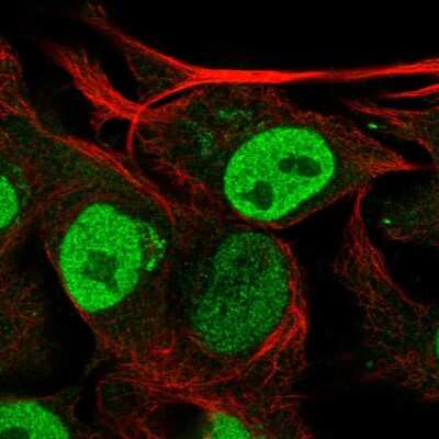 Immunocytochemistry/ Immunofluorescence: KIAA1211 Antibody [NBP2-30539]