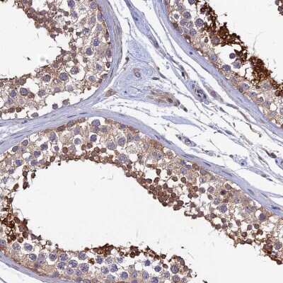 Immunohistochemistry-Paraffin: KIAA1211 Antibody [NBP2-30840]