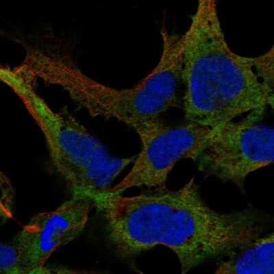 Immunocytochemistry/ Immunofluorescence: KIAA1257 Antibody [NBP2-38582]