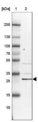 Western Blot: KIAA1257 Antibody [NBP2-14154]