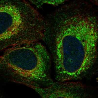 Immunocytochemistry/ Immunofluorescence: KIAA1324L Antibody [NBP2-55924]