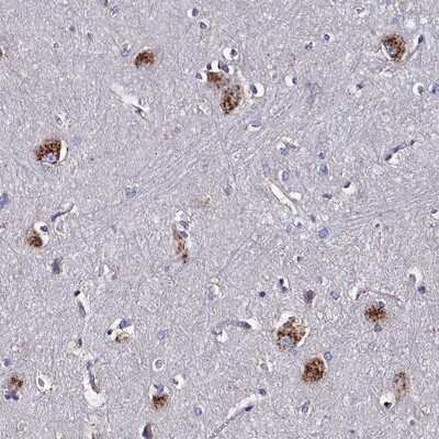 Immunohistochemistry-Paraffin: KIAA1324L Antibody [NBP1-94056]