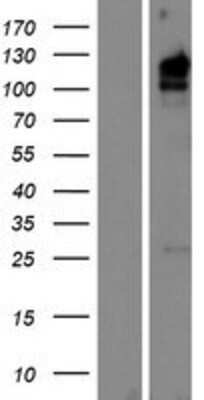 Western Blot: KIAA1324L Overexpression Lysate [NBP2-09669]