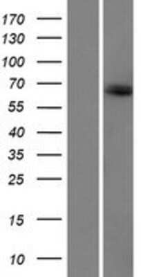 Western Blot: KIAA1328 Overexpression Lysate [NBP2-06613]