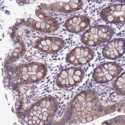 Immunohistochemistry-Paraffin: CCDC191 Antibody [NBP1-94189]