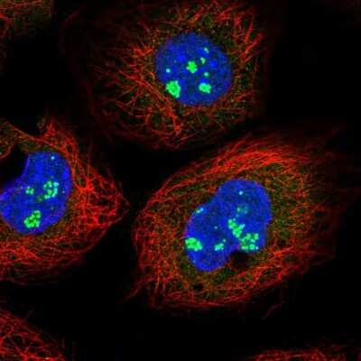 Immunocytochemistry/ Immunofluorescence: CFAP97 Antibody [NBP2-30874]