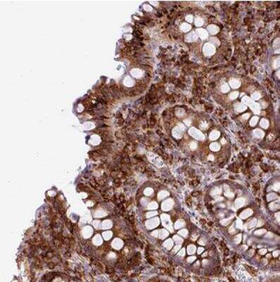 Immunohistochemistry-Paraffin: CFAP97 Antibody [NBP2-30874]