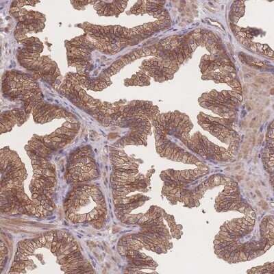 Immunohistochemistry-Paraffin: CFAP97 Antibody [NBP2-47408]