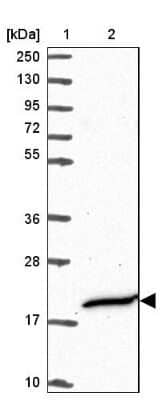 Western Blot: CFAP97 Antibody [NBP2-47408]