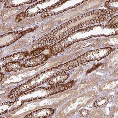 Immunohistochemistry-Paraffin: RIC1 Antibody [NBP2-49012]