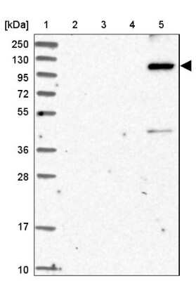 Western Blot: KIAA1468 Antibody [NBP1-93850]