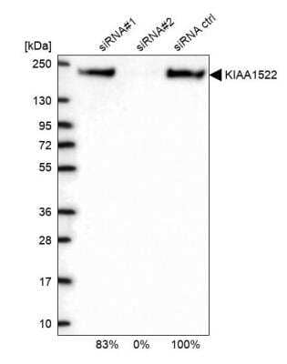 Western Blot: KIAA1522 Antibody [NBP2-58457]