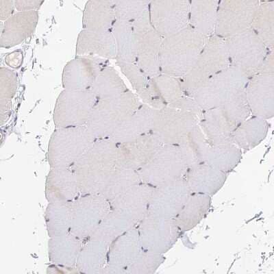 Immunohistochemistry-Paraffin: CAMSAP3 Antibody [NBP1-90961]