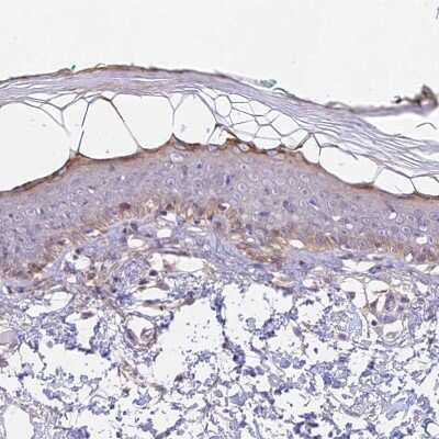 Immunohistochemistry-Paraffin: CAMSAP3 Antibody [NBP1-90961]