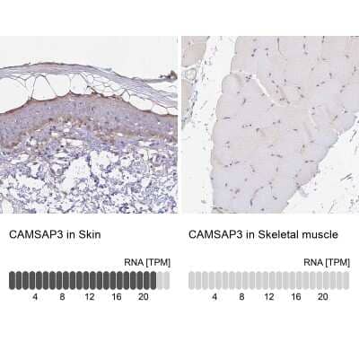 Immunohistochemistry-Paraffin: CAMSAP3 Antibody [NBP1-90961]