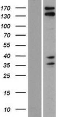 Western Blot: CAMSAP3 Overexpression Lysate [NBP2-08492]