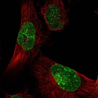 Immunocytochemistry/ Immunofluorescence: KIAA1586 Antibody [NBP1-86291]