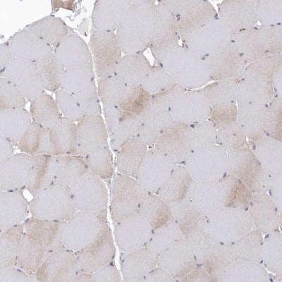 Immunohistochemistry-Paraffin: KIAA1586 Antibody [NBP1-86291]