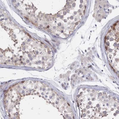 Immunohistochemistry-Paraffin: KIAA1586 Antibody [NBP1-86291]