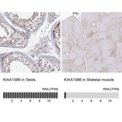 Immunohistochemistry-Paraffin: KIAA1586 Antibody [NBP1-86291]