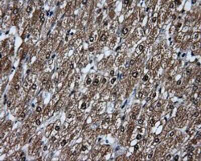 Immunohistochemistry-Paraffin: TLDC1 Antibody (OTI5D9) [NBP2-02352]