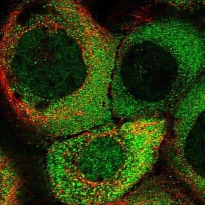 Immunocytochemistry/ Immunofluorescence: TLDC1 Antibody [NBP1-86235]