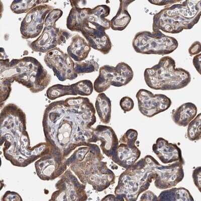 Immunohistochemistry-Paraffin: TLDC1 Antibody [NBP1-86235]