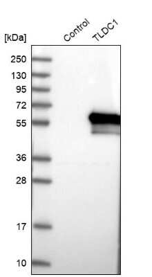 Western Blot: TLDC1 Antibody [NBP1-86235]