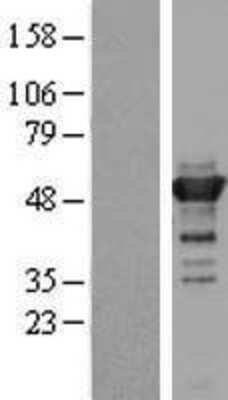 Western Blot: TLDC1 Overexpression Lysate [NBL1-12272]