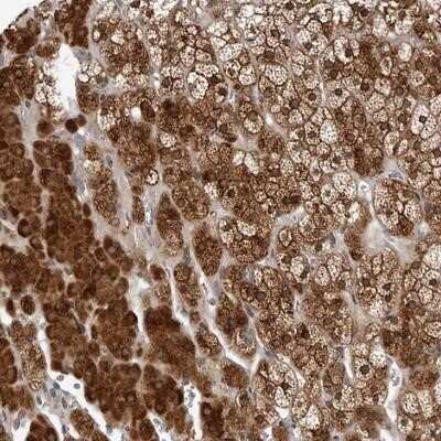 Immunohistochemistry-Paraffin: KIAA1614 Antibody [NBP1-91038]