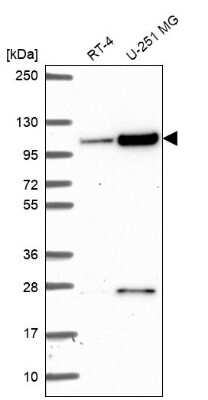 Western Blot: KIAA1614 Antibody [NBP2-56291]