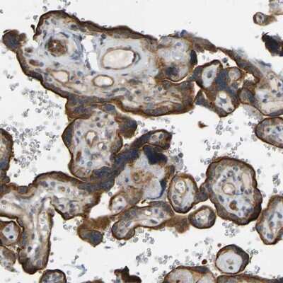 Immunohistochemistry-Paraffin: KIAA1671 Antibody [NBP1-91085]