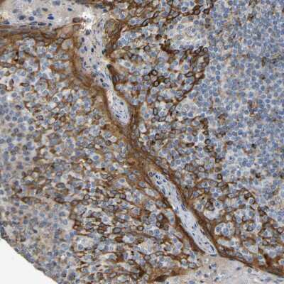 Immunohistochemistry-Paraffin: KIAA1671 Antibody [NBP1-91085]